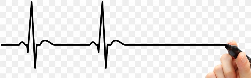 Electrocardiography Heart Arrhythmia Cardiac Muscle Drawing Acute Myocardial Infarction, PNG, 1398x435px, Electrocardiography, Acute Myocardial Infarction, Arm, Cardiac Muscle, Drawing Download Free