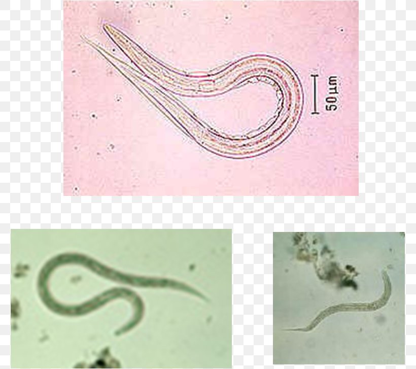 Ancylostoma Duodenale Hookworm Infection Centers For Disease Control And Prevention Invertebrate Email, PNG, 779x727px, Ancylostoma Duodenale, Cdc, Email, Email Address, Fauna Download Free