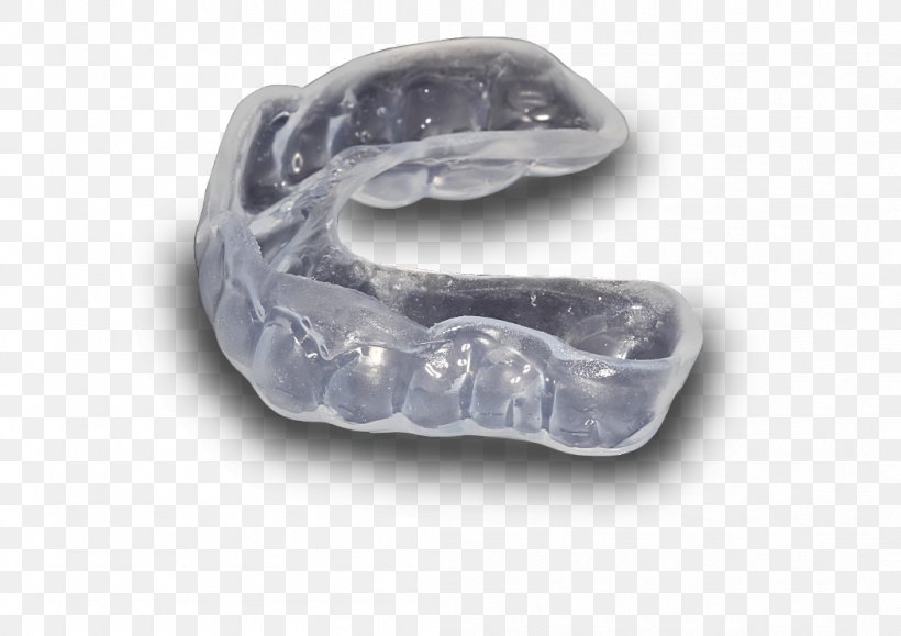 Mouthguard Jaw Dental Laboratory Tooth, PNG, 1052x744px, Mouthguard, Biting, Body Jewellery, Body Jewelry, Bremadent Dental Laboratory Download Free
