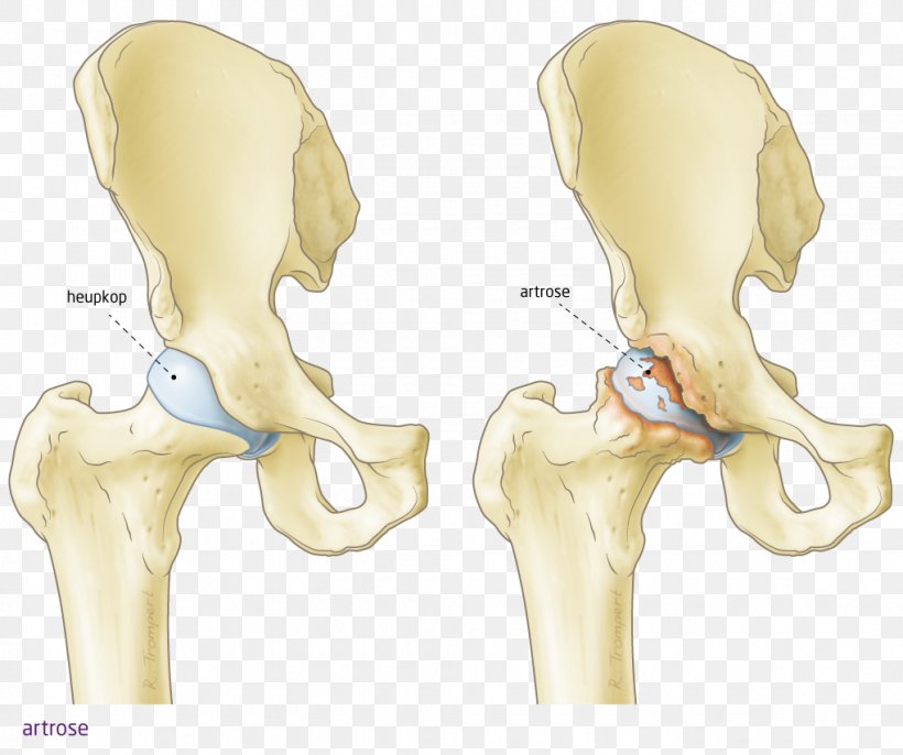 Hip Ear Knee Bone Heupgewricht, PNG, 1020x854px, Watercolor, Cartoon, Flower, Frame, Heart Download Free