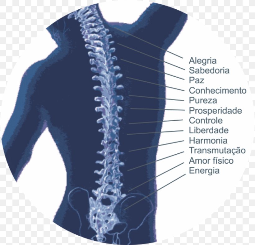 Vertebral Column Therapy Human Back Symptom Osteochondrosis, PNG, 818x786px, Vertebral Column, Calcaneal Spur, Chiropractic, Degenerative Disease, Disease Download Free
