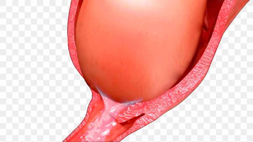 Cervical Mucus Plug Cervical Canal Cervix Blood, PNG, 1024x577px, Watercolor, Cartoon, Flower, Frame, Heart Download Free