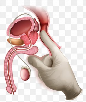 cáncer de próstata 700x400