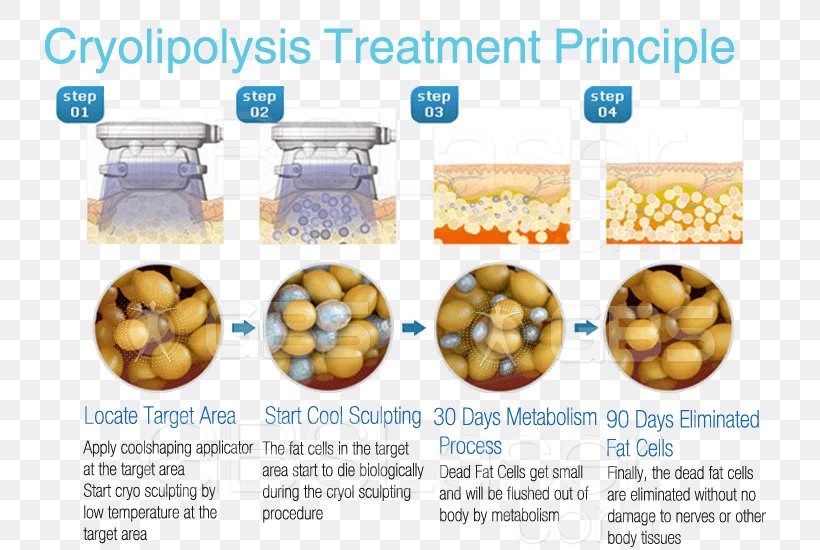 Cryolipolysis Adipose Tissue Adipocyte Fat Apoptosis, PNG, 750x550px, Cryolipolysis, Adipocyte, Adipose Tissue, Apoptosis, Body Contouring Download Free