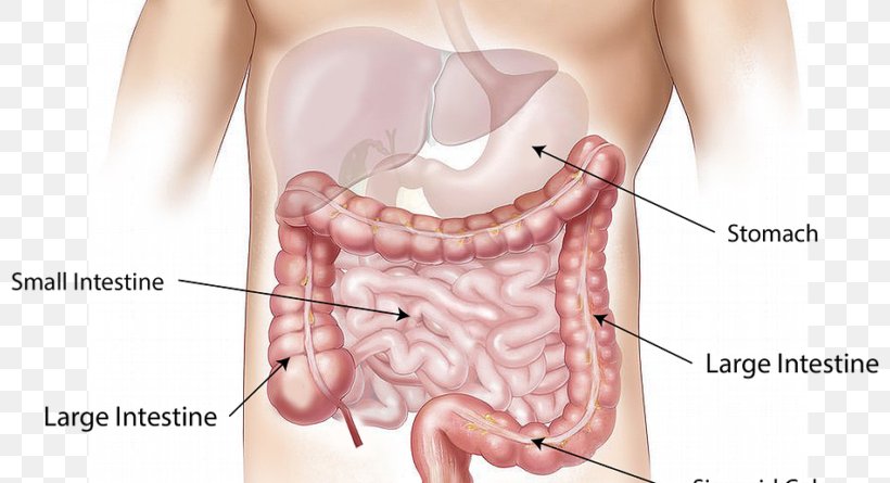 Colorectal Cancer Screening Large Intestine Colonoscopy, PNG, 800x445px, Watercolor, Cartoon, Flower, Frame, Heart Download Free