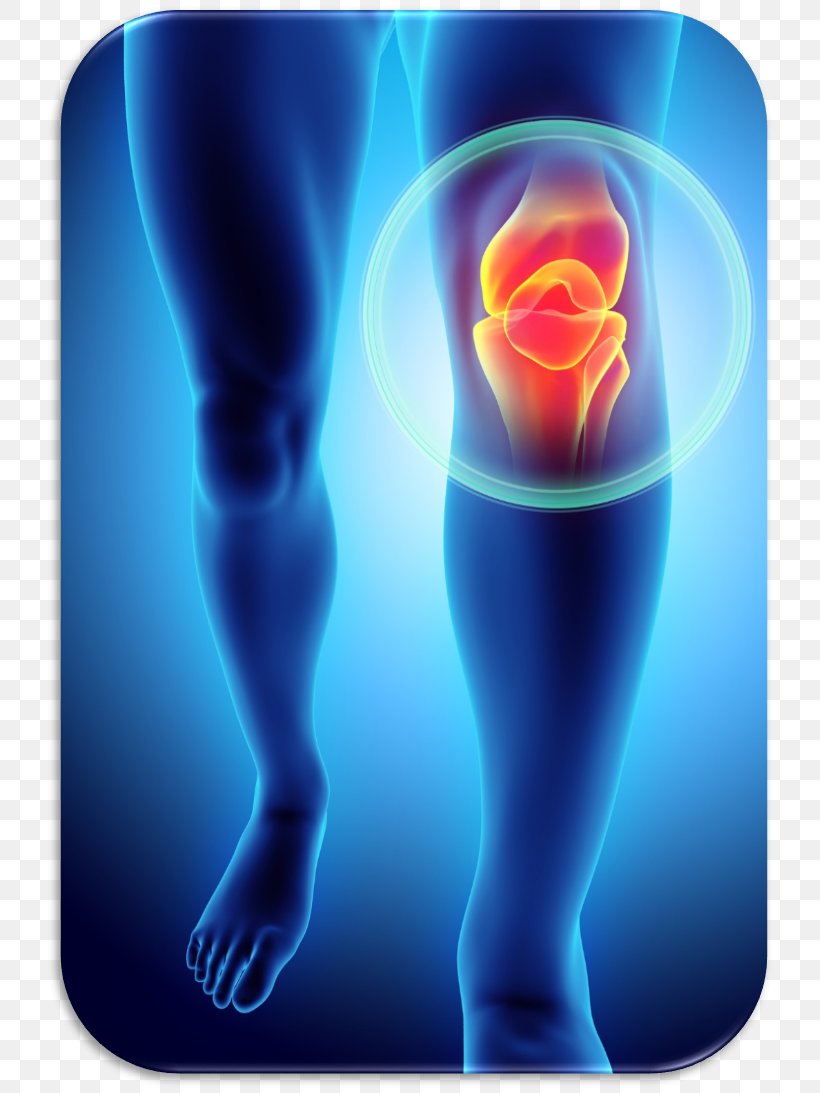 Knee Pain Patellofemoral Pain Syndrome Plica Syndrome