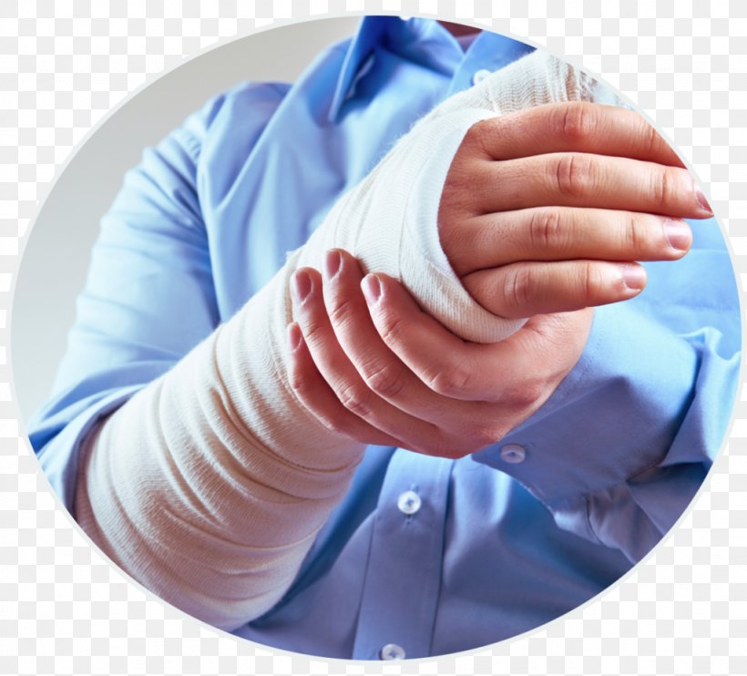 Personal Injury Lawyer Law Firm, PNG, 1024x927px, Personal Injury, Accident, Finger, Hand, Injury Download Free
