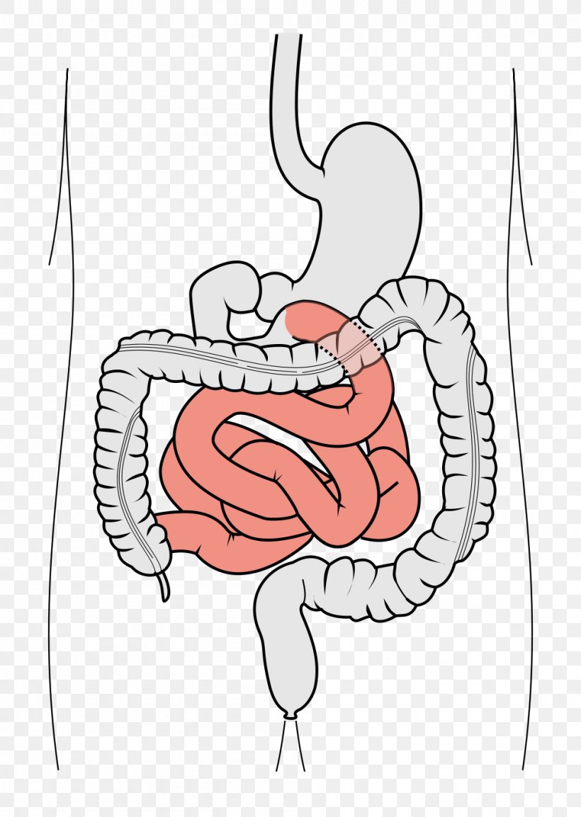 Gastrointestinal Tract Large Intestine Small Intestine Duodenum Leaky Gut Syndrome, PNG, 1000x1408px, Watercolor, Cartoon, Flower, Frame, Heart Download Free