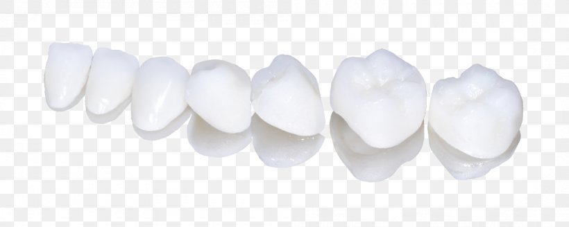 Prosthesis Human Tooth Dentures Body Jewellery, PNG, 1000x401px, Prosthesis, Body Jewellery, Body Jewelry, Dentures, Human Tooth Download Free