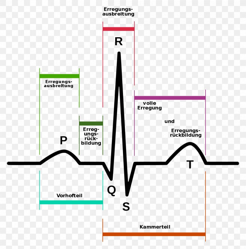 Electrocardiography Heart Arrhythmia Signal Processing Atrial Fibrillation, PNG, 1200x1217px, Electrocardiography, Area, Atrial Fibrillation, Atrium, Brand Download Free