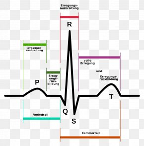 ECG Interpretation Electrocardiography Atrial Fibrillation Clip Art ...