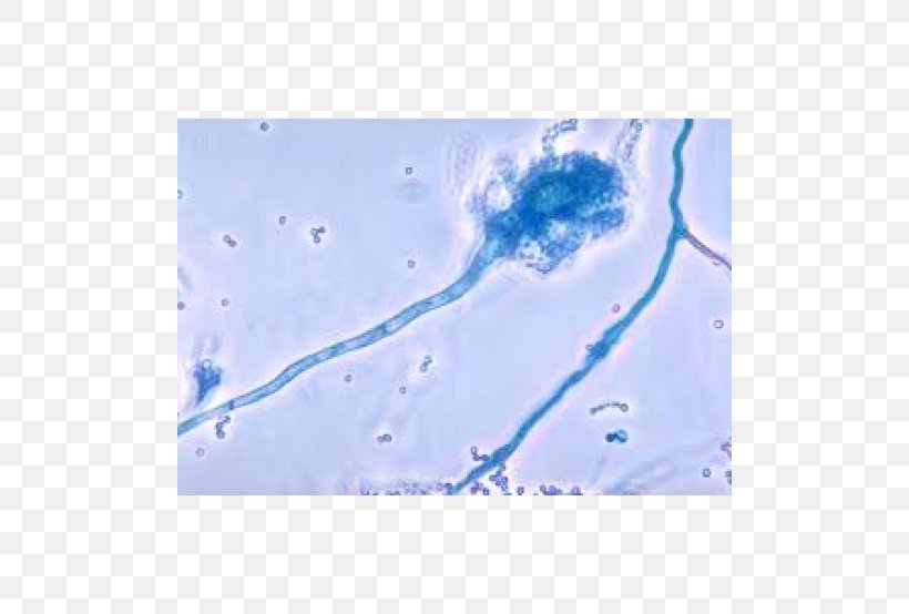 Aspergillus Fumigatus Fungus Aspergillosis Aspergilloma Infection, PNG, 500x554px, Aspergillus Fumigatus, Aspergillosis, Aspergillus, Aspergillus Niger, Blue Download Free