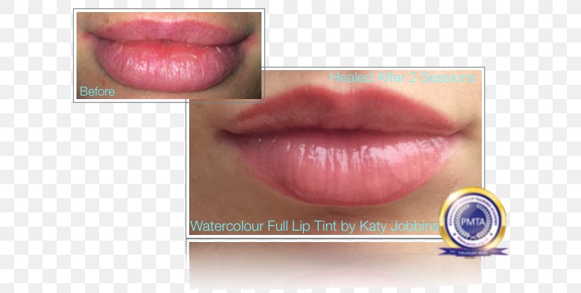 Lip Gloss Lip Augmentation Permanent Makeup Lip Stain, PNG, 632x414px, Lip, Cheek, Color, Cosmetics, Dermis Download Free