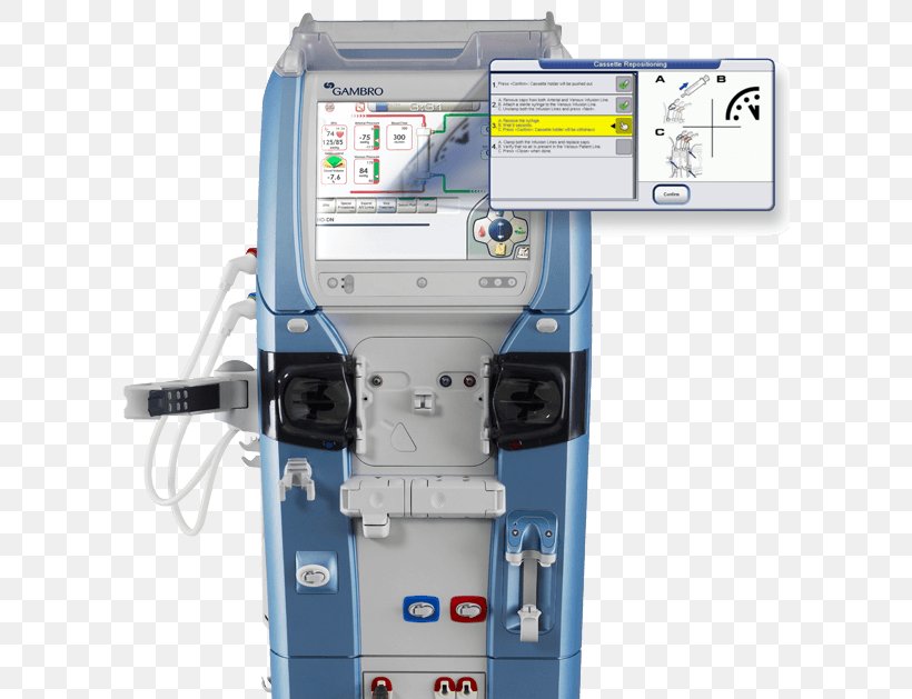 Gambro Hemodialysis Baxter International Physical Therapy, PNG, 600x629px, Gambro, Baxter International, Chronic Condition, Circuit Breaker, Dialysis Download Free