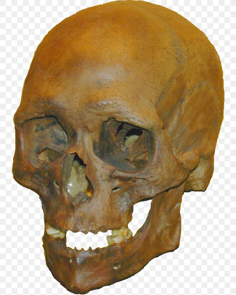 Tautavel Man Stellmoor Skull Homo Sapiens Meiendorf, PNG, 741x1024px, Tautavel Man, Bone, Head, Homo, Homo Ergaster Download Free