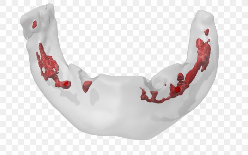 Jaw, PNG, 1050x656px, Jaw, Red, White Download Free