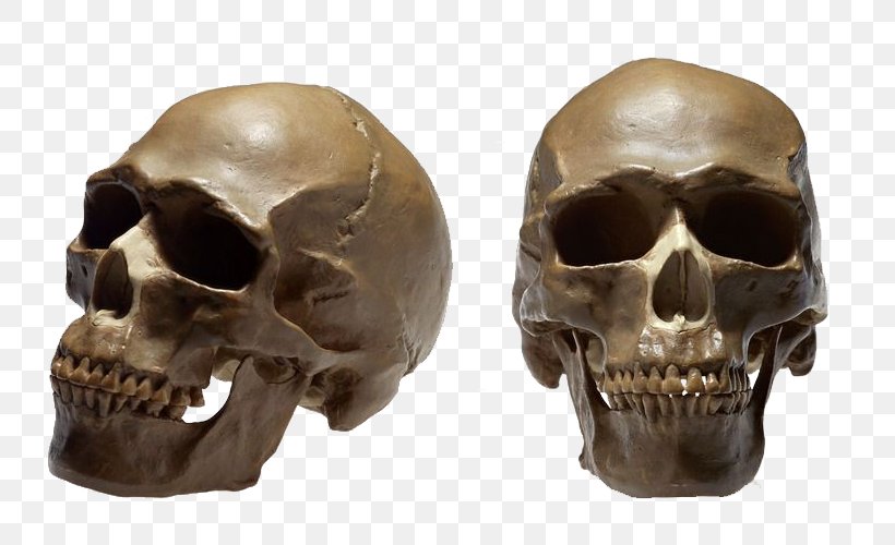 Skull No Homo Sapiens Therapy Ga, PNG, 800x500px, Skull, Bone, Dentist, Disease, Head Download Free