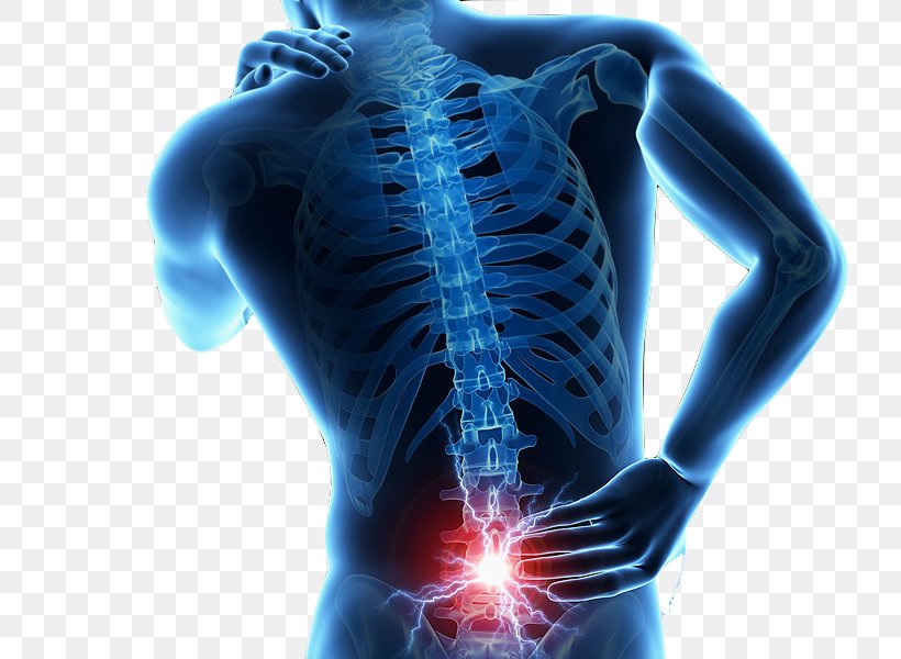 Low Back Pain Human Back Back Injury Vertebral Column, PNG