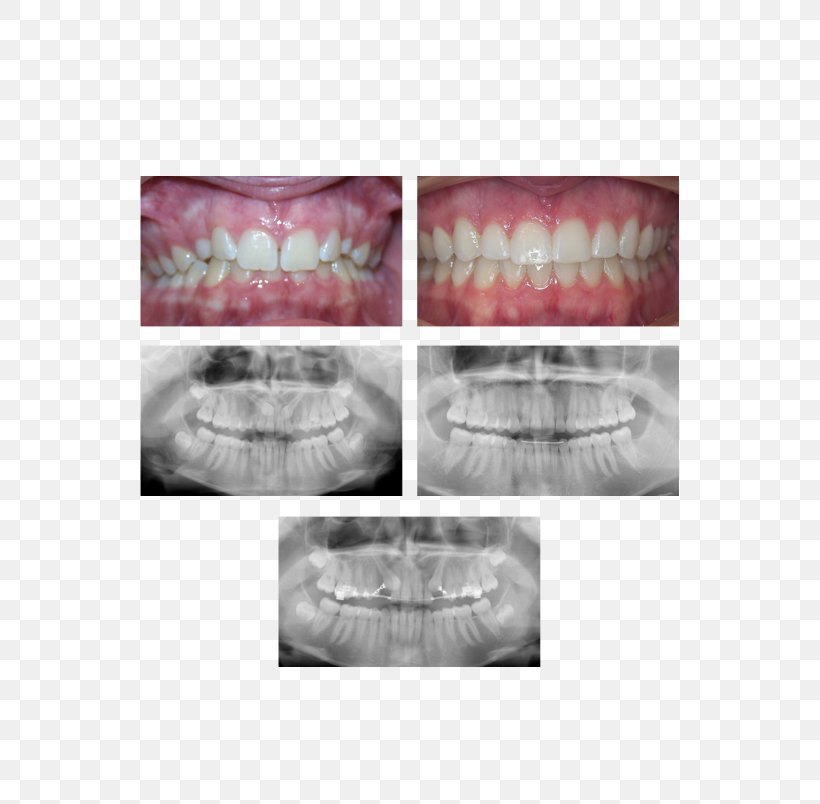 Palatine Mount Prospect Arlington Orthodontics Dental Braces, PNG, 539x804px, Watercolor, Cartoon, Flower, Frame, Heart Download Free