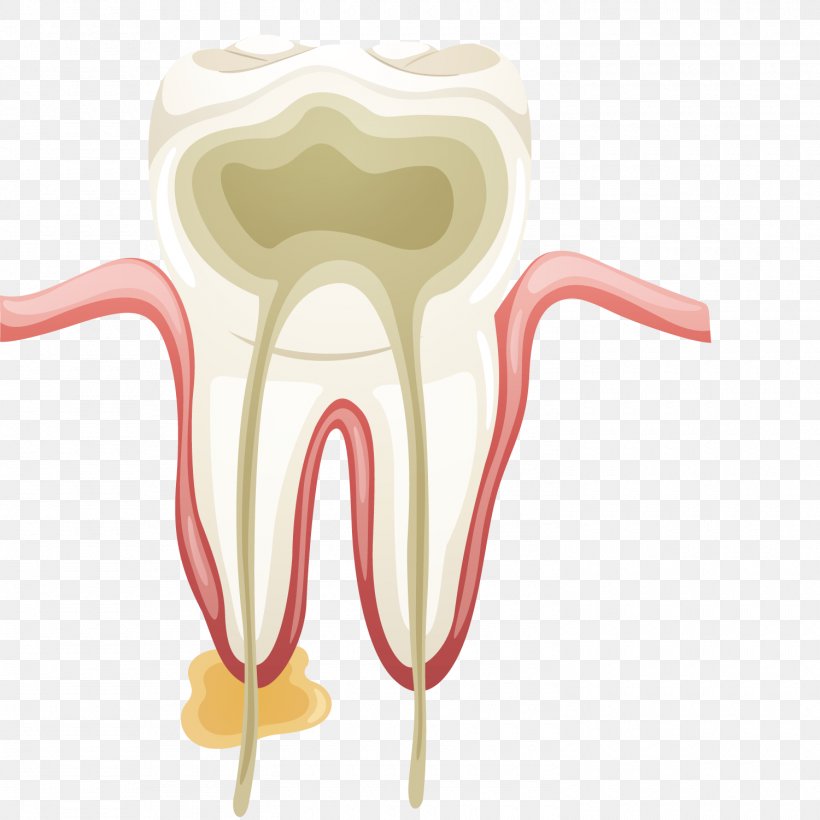 Dentistry Root Canal Tooth Endodontics Endodontic Therapy, PNG, 1500x1500px, Watercolor, Cartoon, Flower, Frame, Heart Download Free