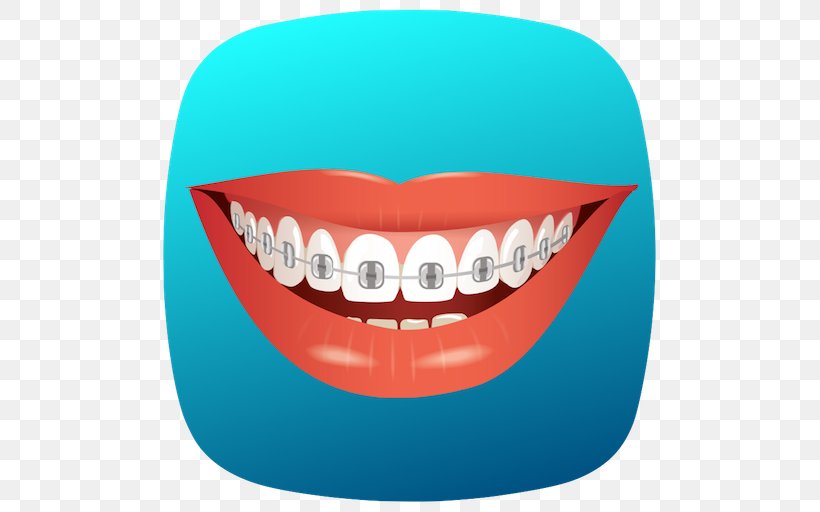 Dental Braces Vector Graphics Royalty-free Smile Lips, PNG, 512x512px, Watercolor, Cartoon, Flower, Frame, Heart Download Free
