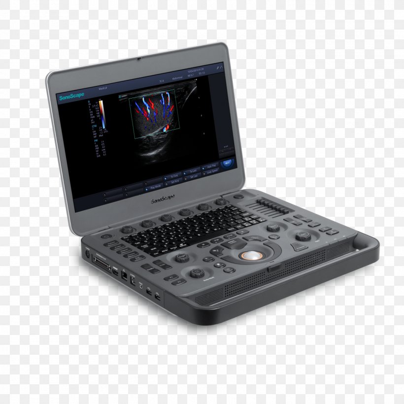 Ultrasound Doppler Ultrasonography SonoScape Medical Corp Color Doppler, PNG, 1500x1500px, Ultrasound, Bmw X3, Bmw X5, Color Doppler, Diagnostic Ultrasound Download Free