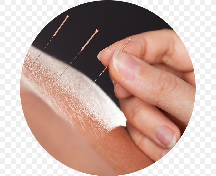 Acupuncture Physical Therapy Traditional Chinese Medicine, PNG, 667x667px, Acupuncture, Acupressure, Akupunktiopiste, Alternative Health Services, Cupping Therapy Download Free