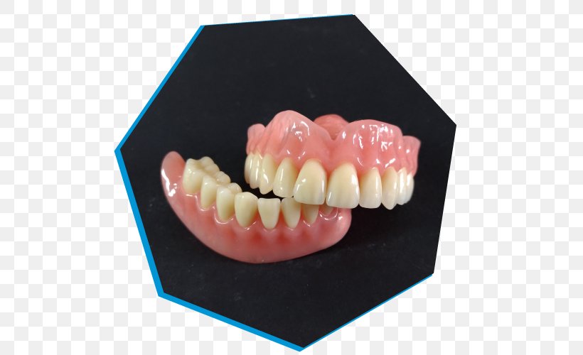 Brembio Dental Laboratory Dentures Tooth Sant'Angelo Lodigiano, PNG, 500x500px, Dental Laboratory, Dental Technician, Dentures, Innovation, Innovazione Tecnologica Download Free