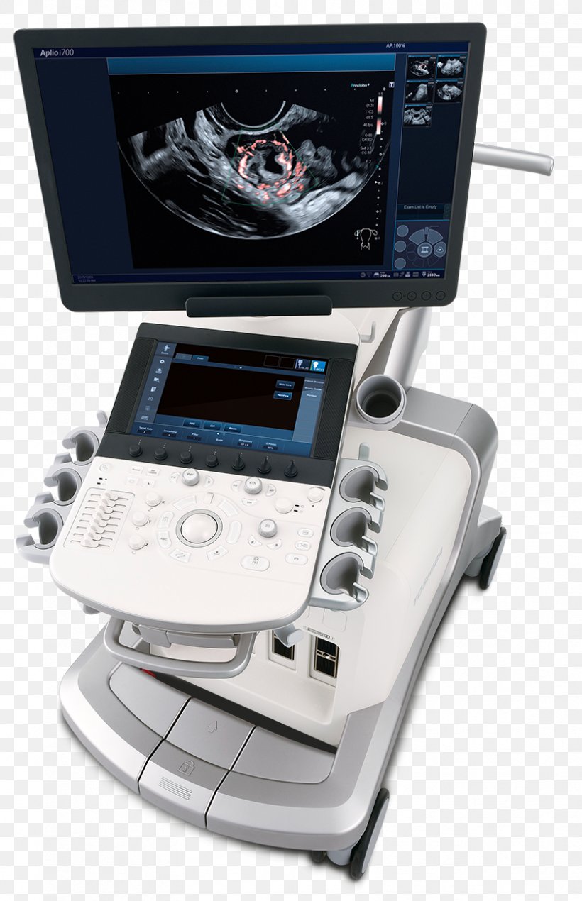 Ultrasonography Ultrasound Canon Medical Systems Corporation Medicine Medical Imaging, PNG, 836x1295px, Ultrasonography, Canon, Canon Medical Systems Corporation, Doppler Fetal Monitor, Electronics Download Free