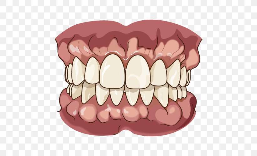 Tooth Jaw Dentures Chewing Bruxism, PNG, 500x500px, Watercolor, Cartoon, Flower, Frame, Heart Download Free