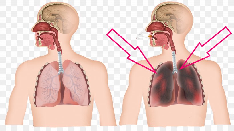 Chronic Obstructive Pulmonary Disease Tobacco Smoking Pulmonology Dyspnea, PNG, 3836x2155px, Watercolor, Cartoon, Flower, Frame, Heart Download Free