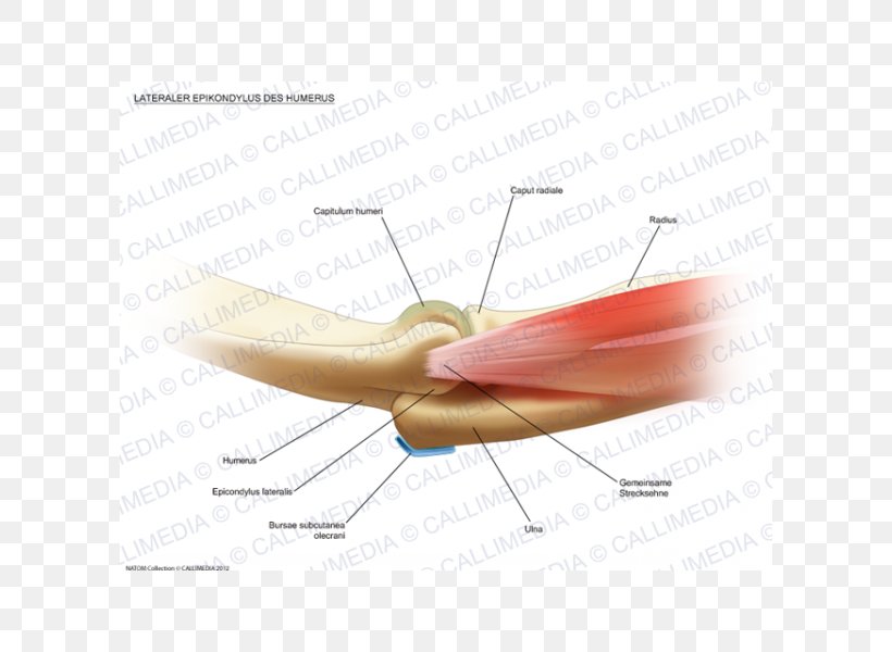 Tennis Elbow Lateral Epicondyle Of The Humerus Tendon, PNG, 600x600px, Tennis Elbow, Anatomy, Bone, Debridement, Elbow Download Free