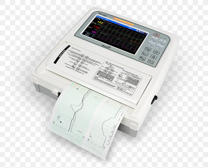 Doppler Fetal Monitor Cardiotocography Fetus Health Care Computer Monitors, PNG, 1000x809px, Doppler Fetal Monitor, Antepartum Bleeding, Cardiotocography, Computer Monitors, Electronics Download Free