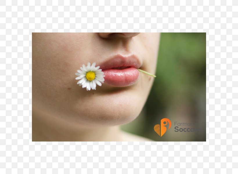 Herpes Labialis Herpes Simplex Virus Lip, PNG, 600x600px, Herpes Labialis, Cheek, Chin, Close Up, Disease Download Free