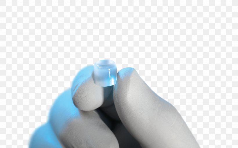 Thumb Implant Podiatry Hallux Toe, PNG, 1600x994px, Thumb, Arm, Bone, Finger, Foot Download Free