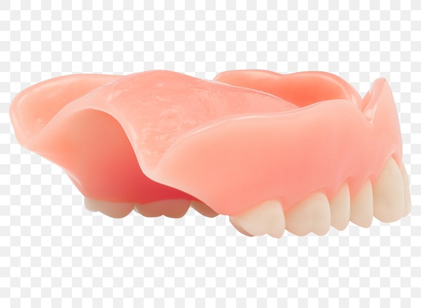 Dentures Jaw Aspen Dental Dentistry, PNG, 800x600px, Dentures, Aspen Dental, Blog, Dentistry, Digital Media Download Free