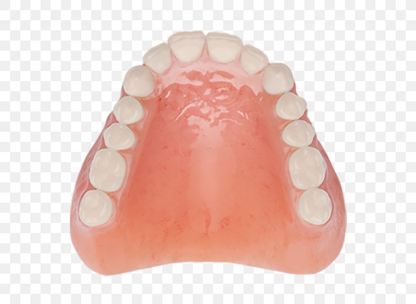Tooth Dentures Dentistry Removable Partial Denture Aspen Dental, PNG, 800x600px, Tooth, Aspen Dental, Clinic, Complexion, Dentistry Download Free