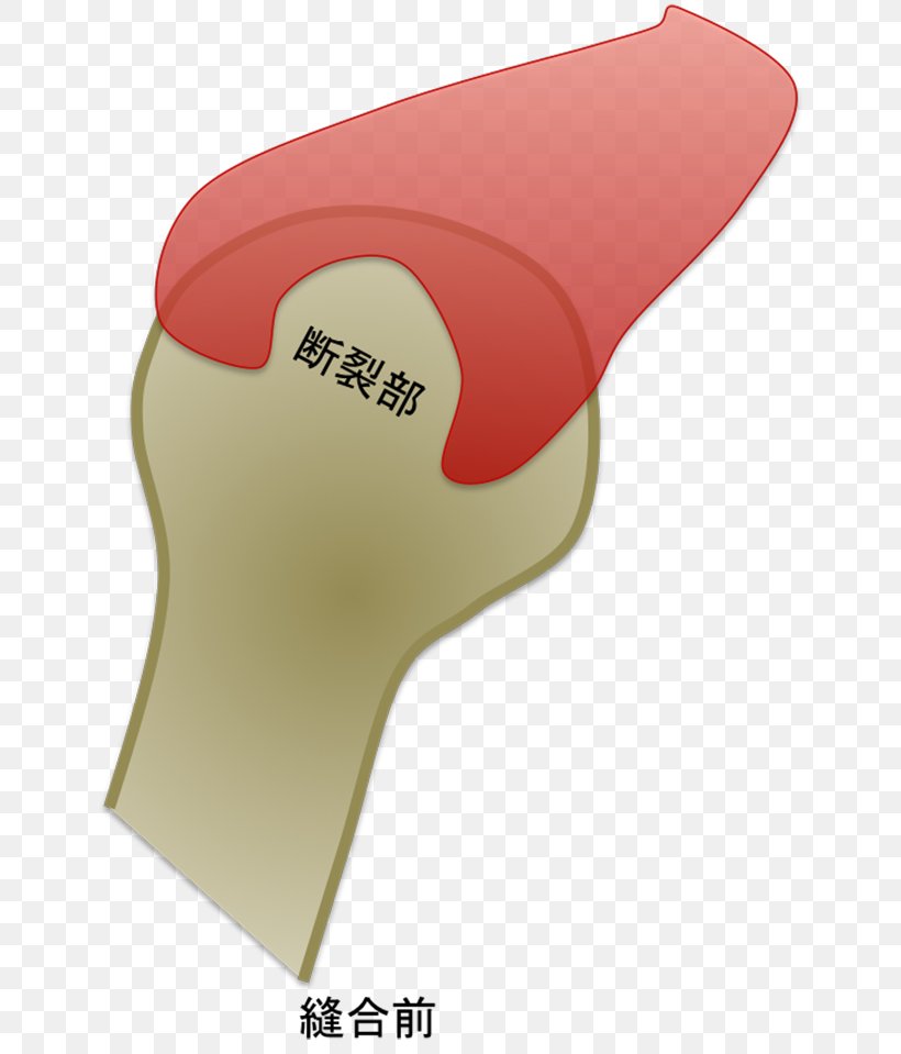 Shoulder Joint Rotator Cuff Humerus, PNG, 650x959px, Shoulder Joint, Arm, Friction, Fukuoka, Humerus Download Free