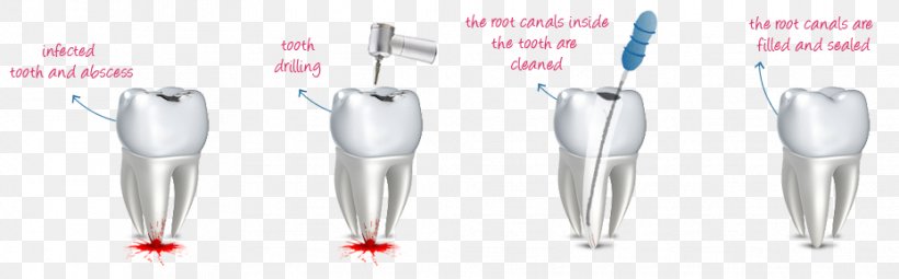 Dental Mint Endodontic Therapy Root Canal Human Tooth, PNG, 929x289px, Watercolor, Cartoon, Flower, Frame, Heart Download Free