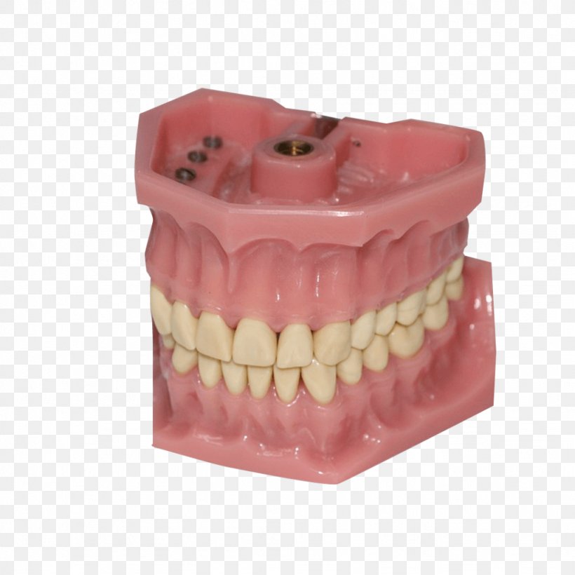 Dentistry Human Tooth Dentures Bruxism, PNG, 1024x1024px, Dentist, Bridge, Bruxism, Crown, Dental Surgery Download Free