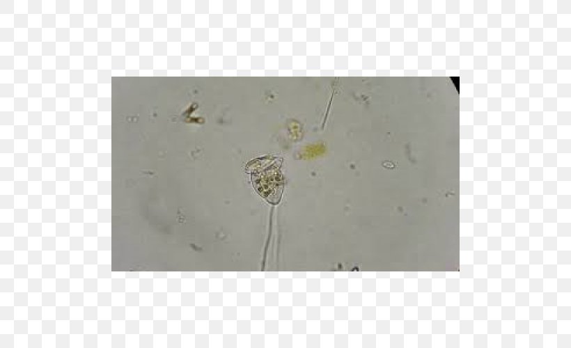Vorticella Glass Microscope Slides Science Plastic, PNG, 500x500px, Glass, Google Slides, Microscope Slides, Mite, Organism Download Free