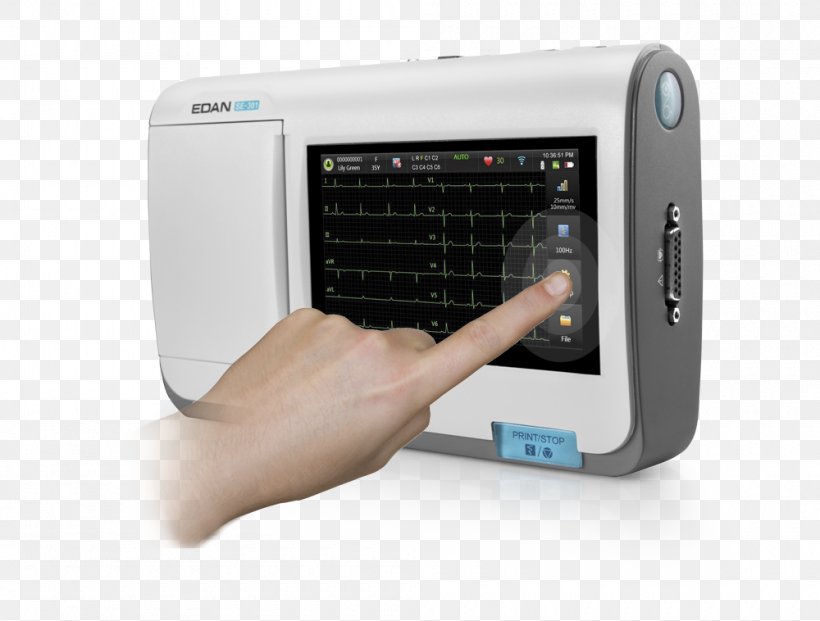 Electrocardiography Medicine Holter Monitor Electrocardiogram Medical Diagnosis, PNG, 1000x758px, Electrocardiography, Cardiology, Computer, Computer Monitors, Diagnose Download Free