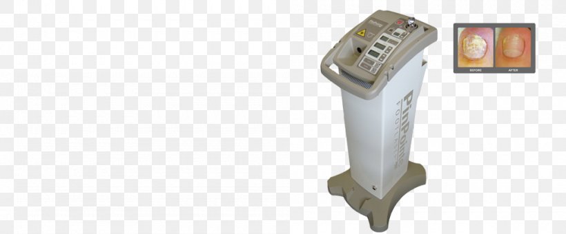 Onychomycosis Nail Laser Surgery Foot, PNG, 1000x415px, Onychomycosis, Cause, Computer Hardware, Embedded System, Foot Download Free