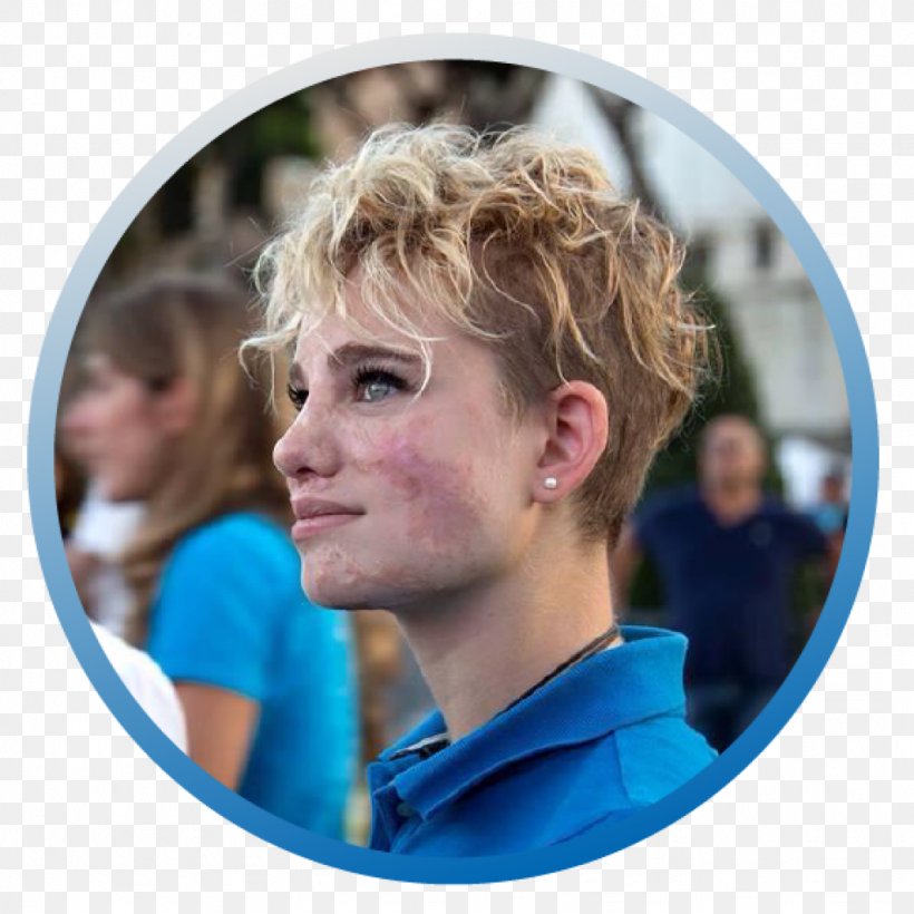 Beatrice Vio Fiumicino 2016 Summer Paralympics Meningitis Foil, PNG, 1024x1024px, 2016 Summer Paralympics, Beatrice Vio, Athlete, Cheek, Chin Download Free