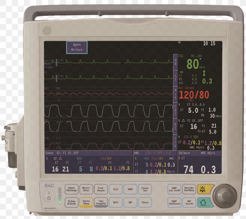 Medical Equipment GE Healthcare Monitoring Electronics Anesthesia, PNG, 1209x1078px, Medical Equipment, Anaesthetic Machine, Anesthesia, Computer Monitors, Display Device Download Free