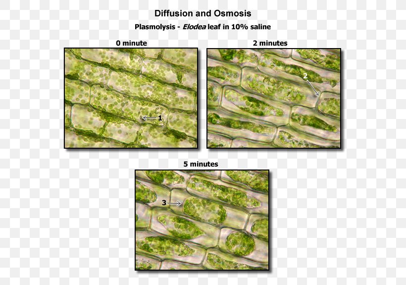 Plasmolysis Plant Cell Microscope Biology, PNG, 600x575px, Plasmolysis, Biology, Cell, Cell Membrane, Elodea Canadensis Download Free
