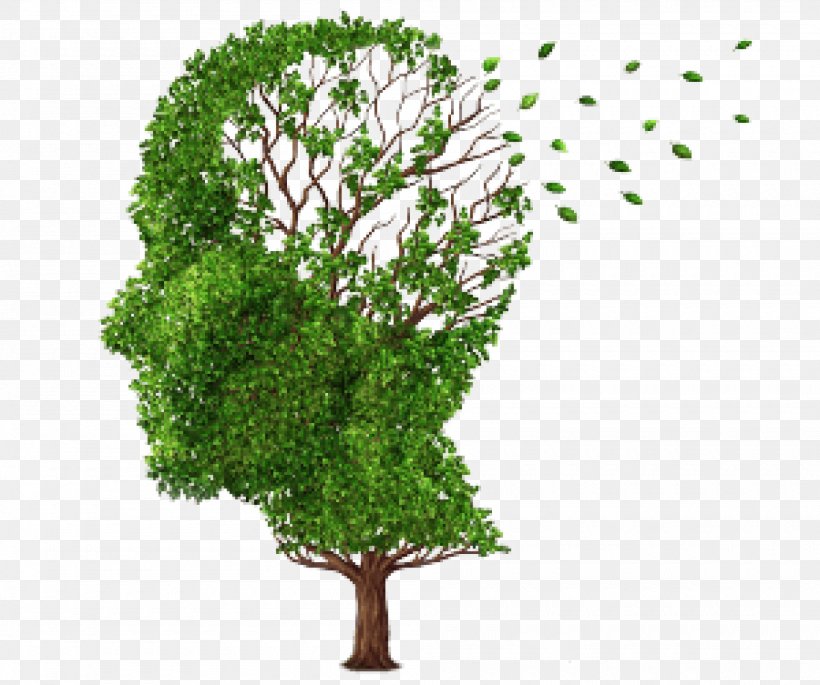 Alzheimer's Disease Brain Alzheimer's Association Health, PNG, 2000x1673px, Disease, Amyloid, Amyloid Beta, Brain, Brain Damage Download Free