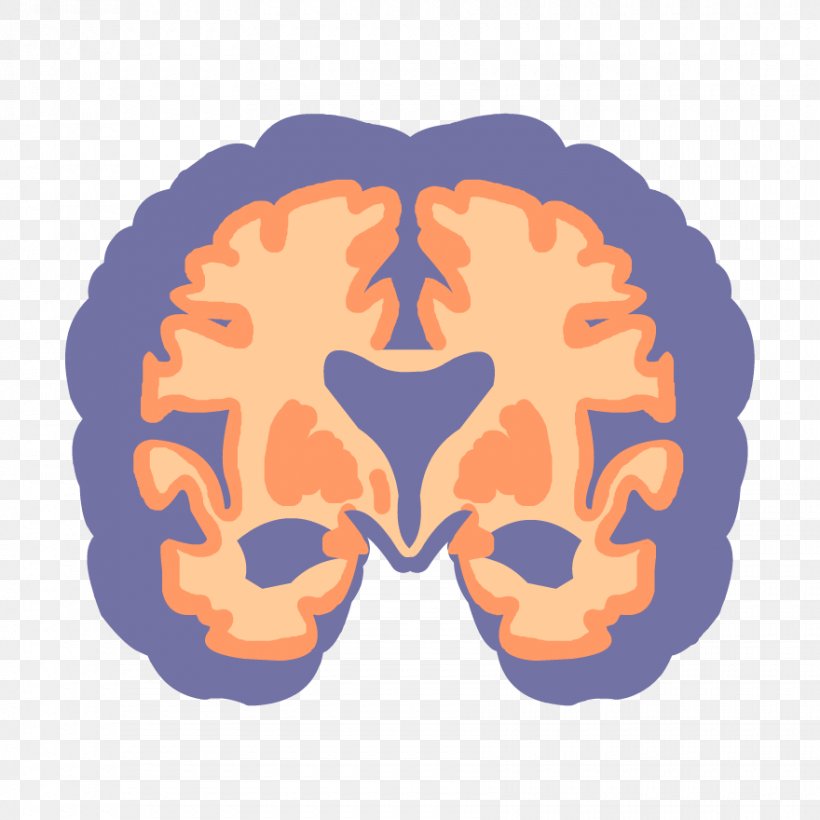 Cartoon Brain, PNG, 880x880px, Alzheimers Disease, Ageing, Alzheimers And Dementia, Brain, Cerebral Palsy Download Free
