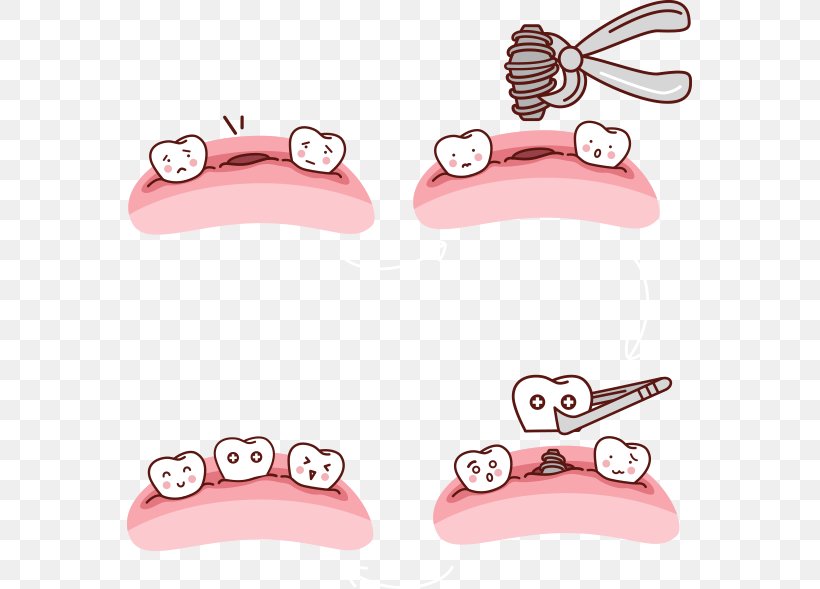 Drawing Tooth Dental Implant, PNG, 565x589px, Drawing, Animaatio, Body Jewelry, Cartoon, Dental Implant Download Free