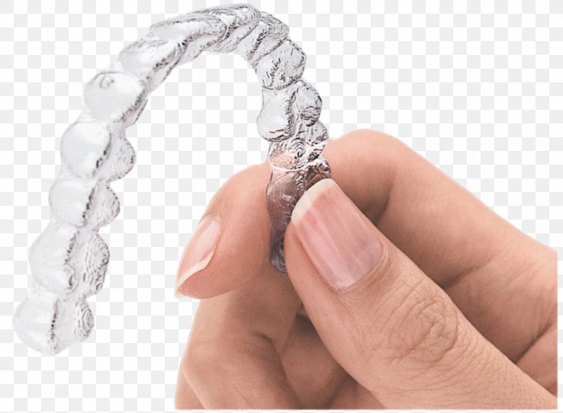 Clear Aligners Dentistry Orthodontics Dental Braces, PNG, 1024x752px, Clear Aligners, Cosmetic Dentistry, Dental Braces, Dental Implant, Dentist Download Free